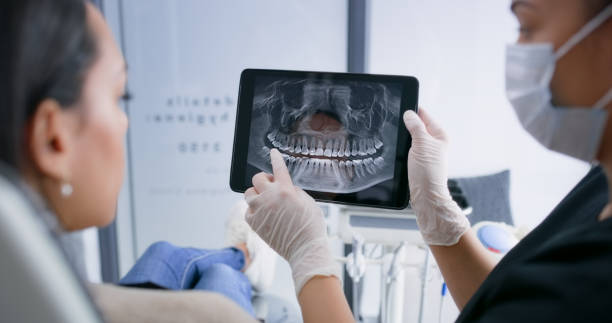 Licensed Tooth Extraction service in Granbury, TX - Smile Center Dentistry